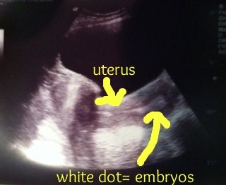 photo embryosinuteruscropped_zpsb7e1187c.jpg
